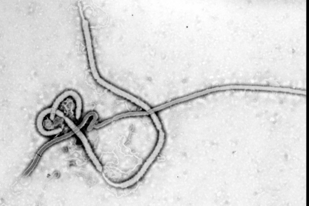 Ebola vírus partikulum elektronmikroszkópos felvétele.
Forrás: wikipedia.org
Szerző: Feltöltő: Splintercellguy