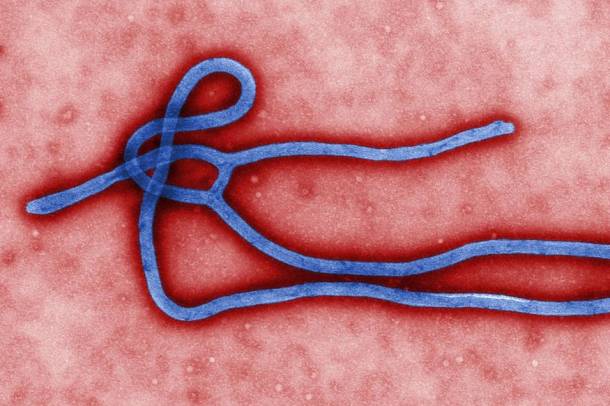 Ebola
Forrás: pixabay.com