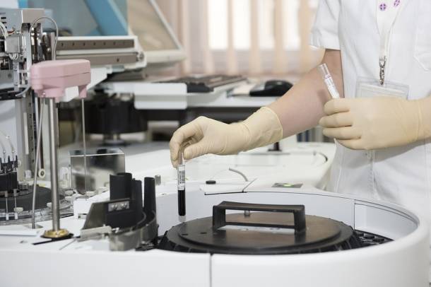 A laboratóriumi őssejtek egyenként tíz vérlemezkét hoznak létre
Forrás: pixabay.com