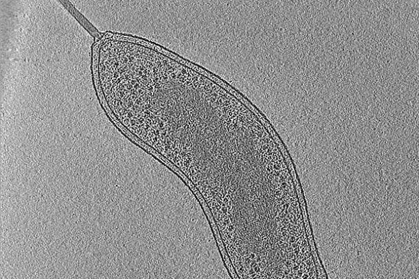 Ragadozó baktérium (képrészlet)
Forrás: commons.wikimedia.org
Szerző: Eikosi