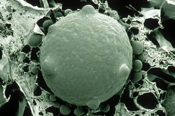 Egy veszélyes gomba, a batrachochytrium dendrobatidis elektronmikroszkópos felvétele
Forrás: en.wikipedia.org
Szerző: Dr Alex Hyatt, CSIRO Livestock Industries' Australian Animal Health Laboratory (AAHL)