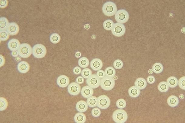 Cryptococcus neoformans gomba (képünk illusztráció)
Forrás: commons.wikimedia.org
Szerző: Dr. Leanor Haley, CDC