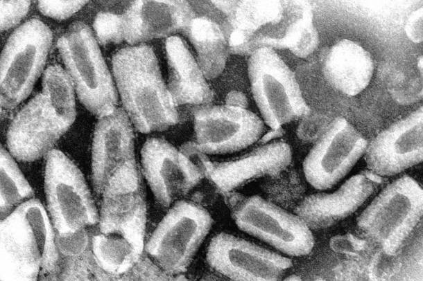 A veszettség vírusa mikroszkóp alatt
Forrás: www.utmb.edu
Szerző: Fred Murphy / University of Texas